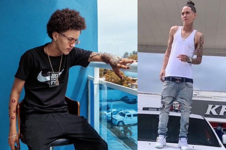 “Onguito” sufre accidente y atropella a dos personas