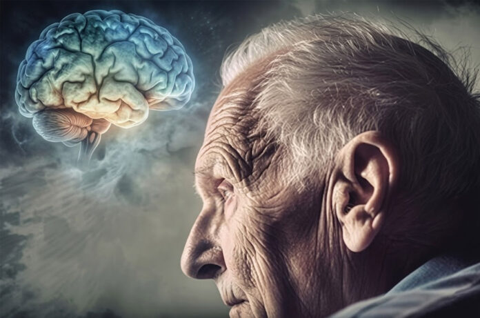 Enfermedad de Alzheimer