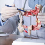 Cáncer gastrointestinal