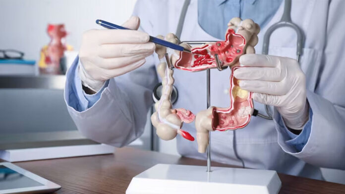 Cáncer gastrointestinal