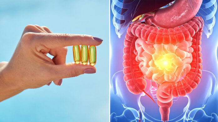 Vitamina D en EII